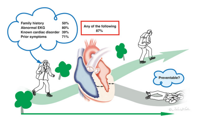 Sudden Heart Attack Deaths: 6 Lifestyle Modifications to Prevent Heart  Diseases In Youngsters