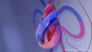 cardiomyopathy illustration