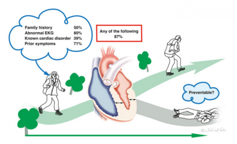 The majority of young people dying from sudden cardiac death due to HCM present with one or more abnormalities that may be recognized during cardiac screening.