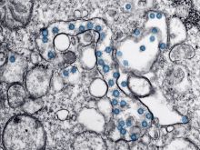 What heart patients should know about coronavirus