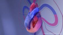 cardiomyopathy illustration