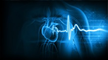 ECG
