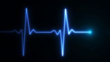echocardiogram